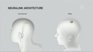 Neuralink 電極比較