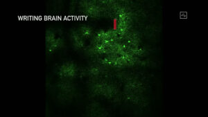 Neuralink 書き込み実験2